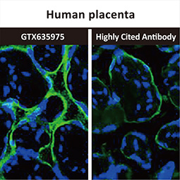 PD-L1 antibody [HL1041] (GTX635975)